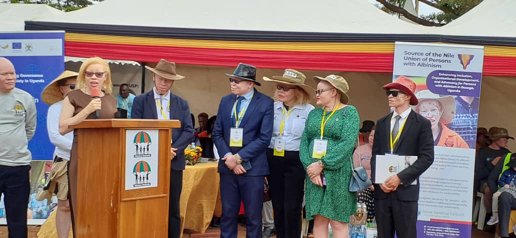 Albinism Community Calls for More Dermatologists in Hospitals