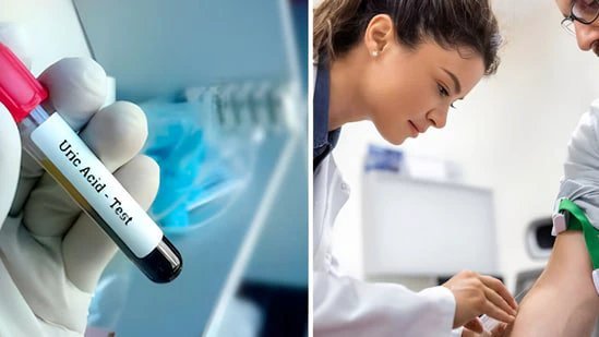 High uric acid? Experts explain 5 underlying health conditions that might be the real cause