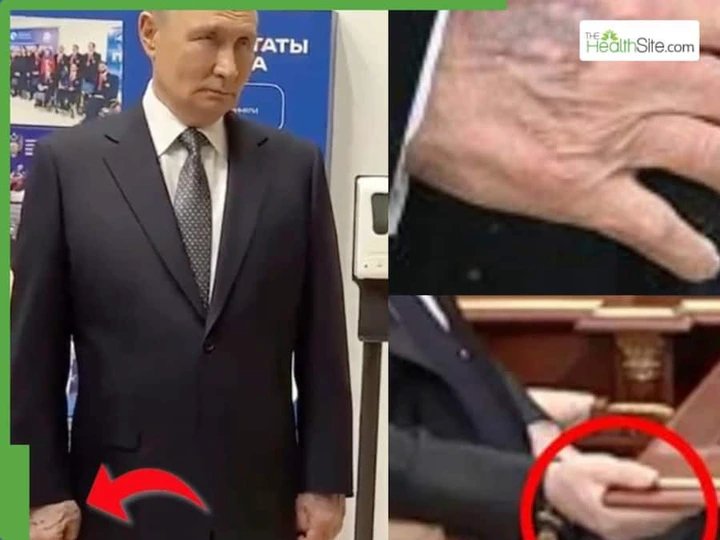 Vladimir Putin’s Swollen Hand And Bulging Veins Sparks Health Rumours After Leaked Chat With Xi Jinping 