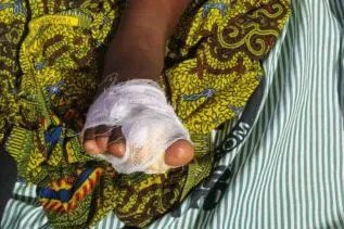 Mother arrested for allegedly cutting off daughter’s toe as punishment