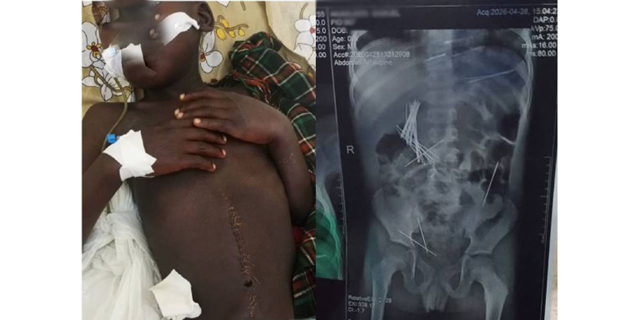 Woman arrested for allegedly forcing stepson, 8, to swallow 46 needles