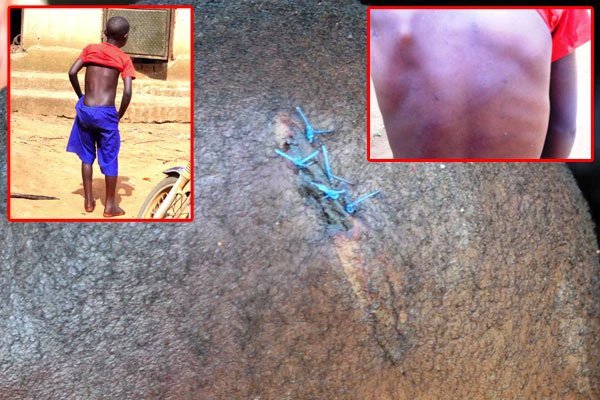 Lwengo man locks 10-year-old son in tarpaulin after brutal machete attack