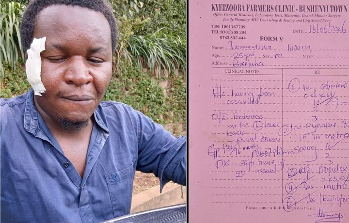 UJA demands probe into journalists tortured over police absenteeism story in Mitooma
